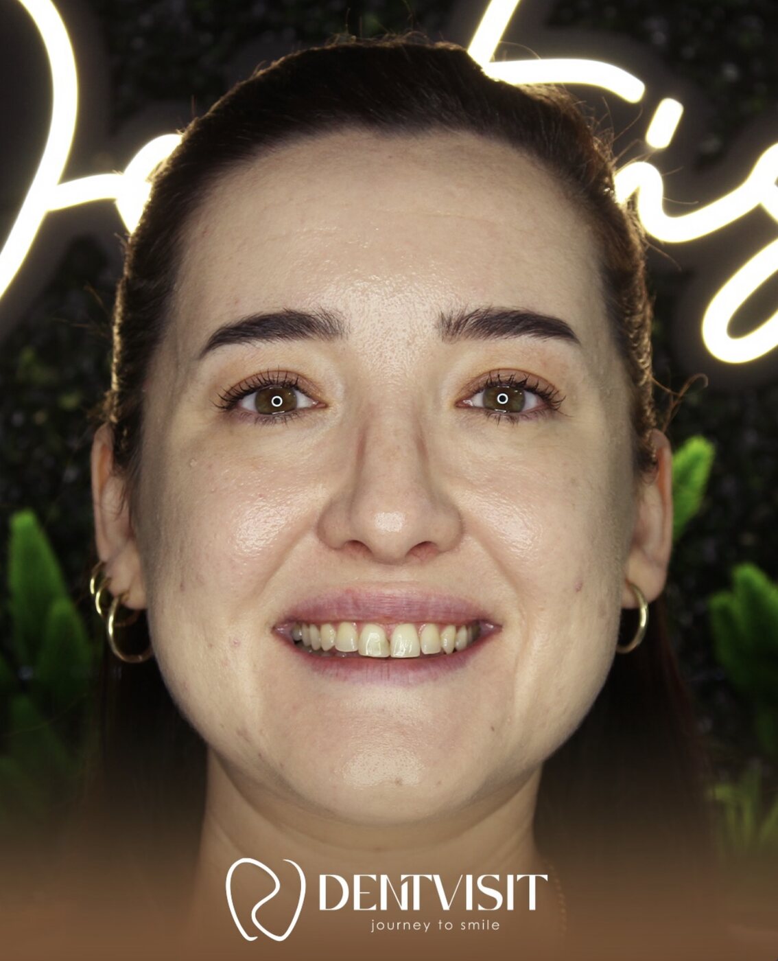 DentVisit — Yeni Gülüş